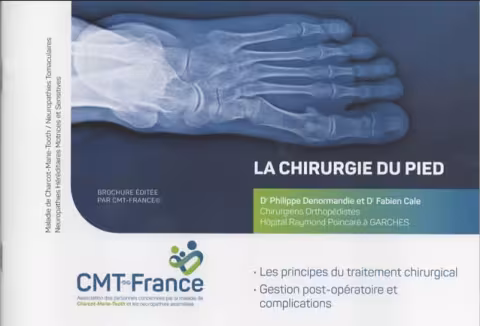 Brochure CMT et chirurgie du pied  